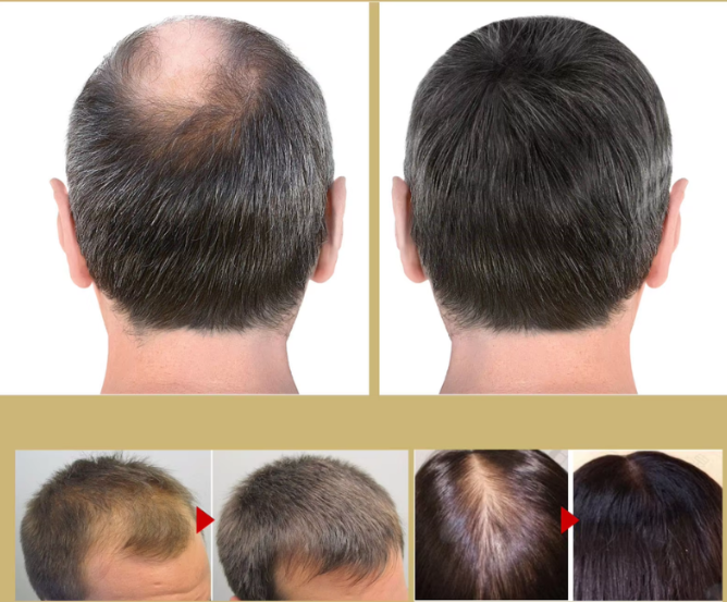 Haarpflege Set für Dicke Gesunde Haare
