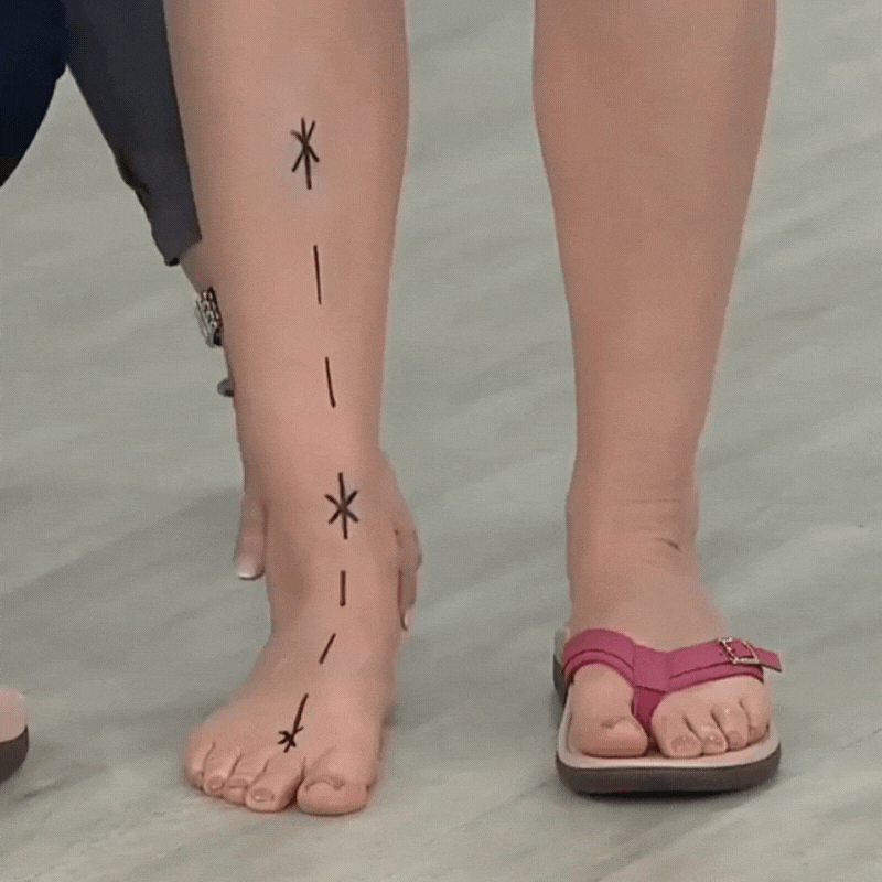 OrthoSummer™ – Orthopädische Sommersandalen für Komfort & Eleganz